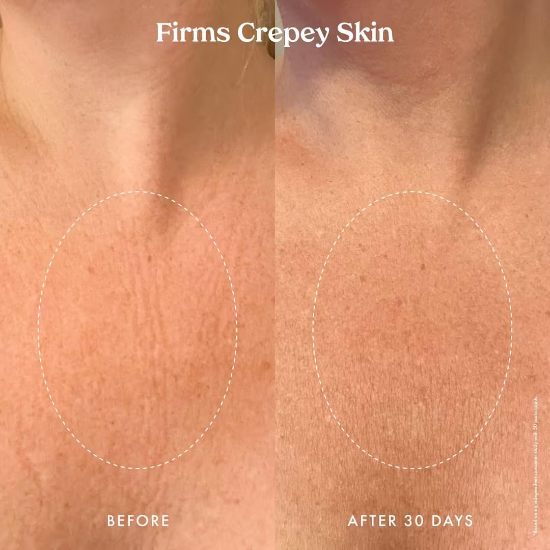 Kopari Ultra Renewal Retinol Body Cream amino butyric acid supports collagen production.