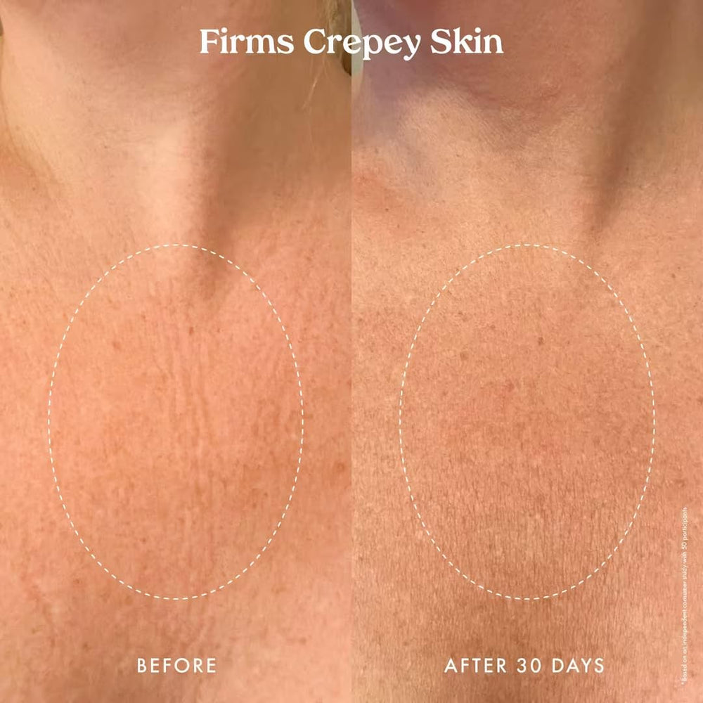 Kopari Ultra Renewal Retinol Body Cream amino butyric acid supports collagen production.