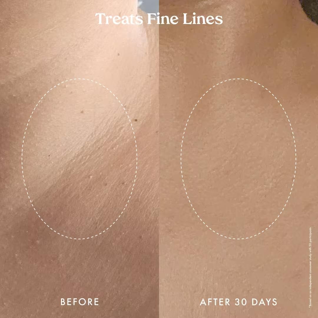 Kopari Ultra Renewal Retinol Body Cream antioxidants protect and even skin tone.