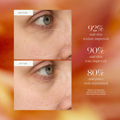 KORA Organics Turmeric Glow Drops with turmeric image emphasizes natural pigment clarity.
