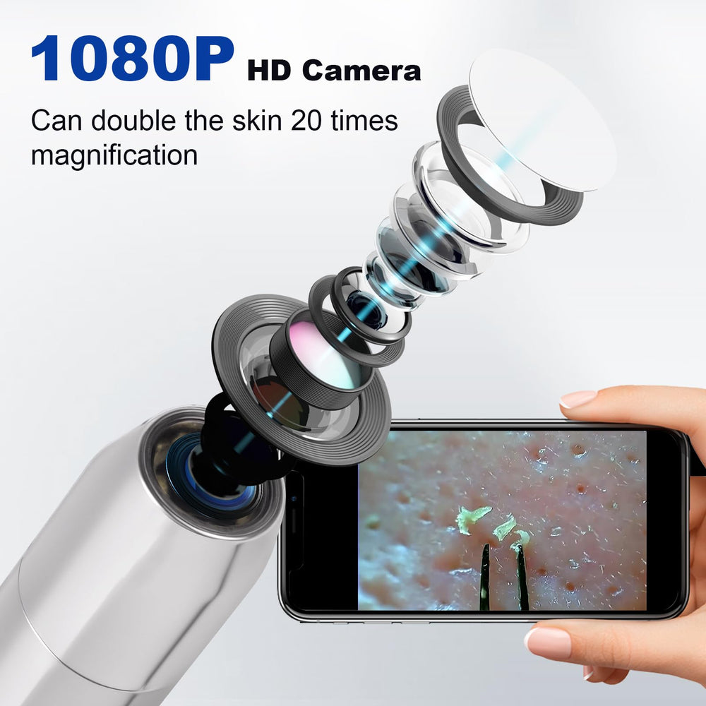 Kosimai Black Head Remover app-stream demonstrates real-time skin detail on-device display.