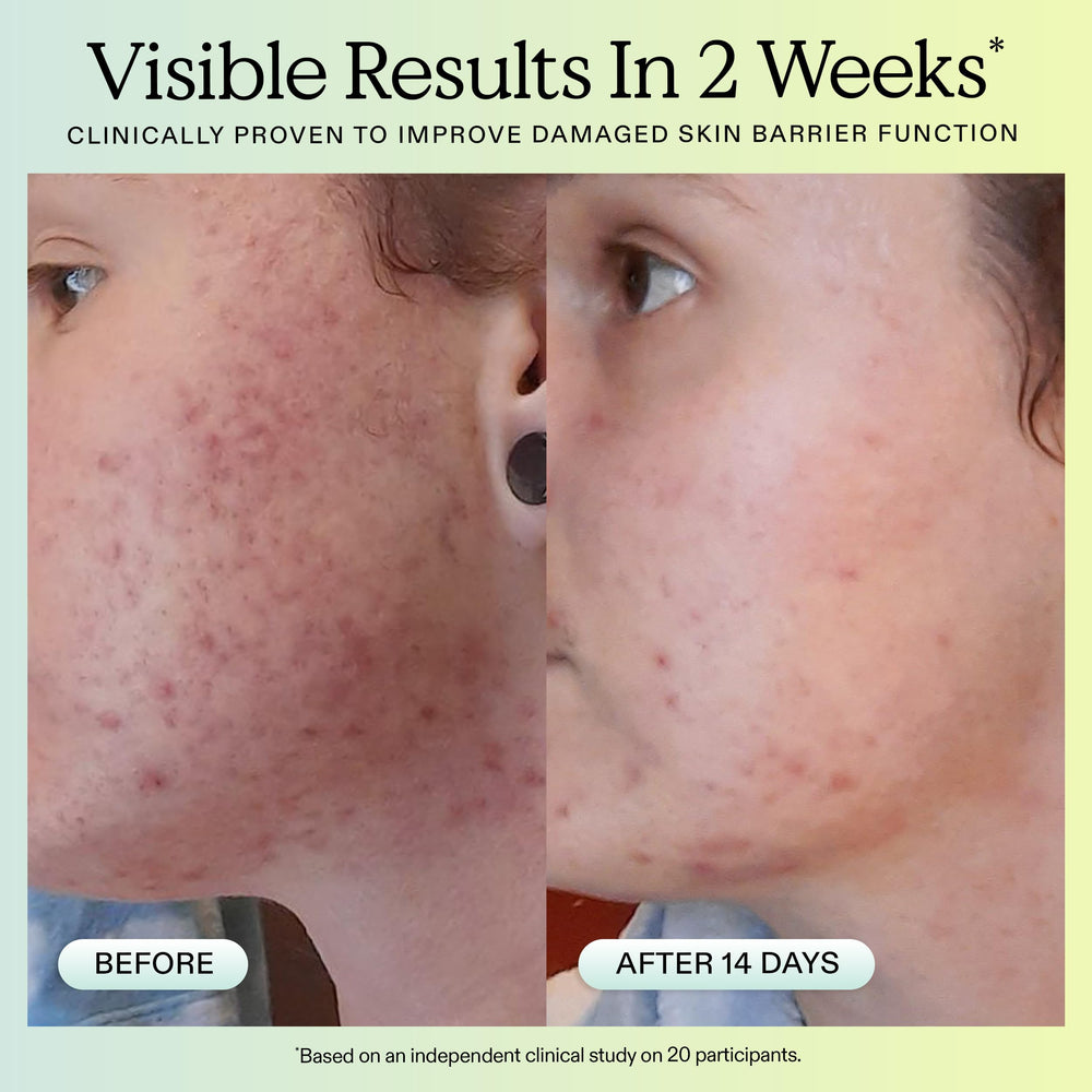 KraveBeauty being applied on skin demonstrating calming hydration benefit