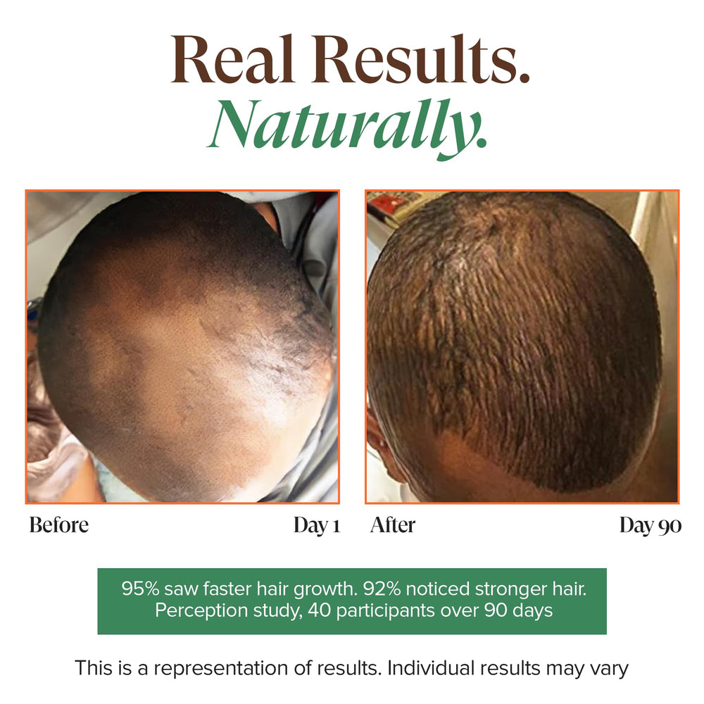 KREYOL ESSENCE oil for eyebrows and lashes supports grooming and fuller look.