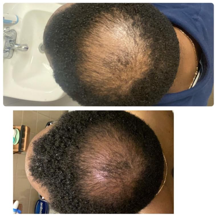 Kreyol Essence Shea Butter emulsion illustrates lasting hydration and frizz control.