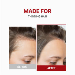 KUNDAL caffeine hair tonic being applied to scalp for targeted care