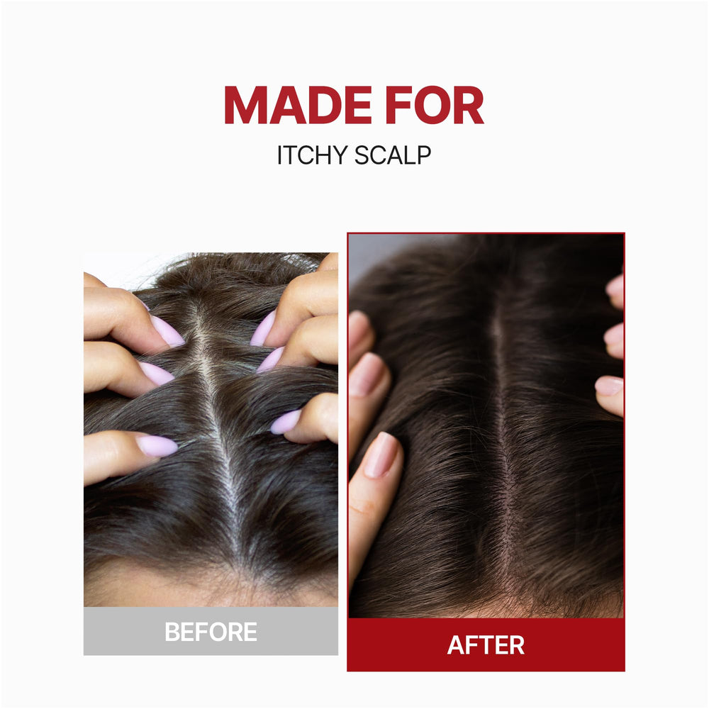 KUNDAL tea tree oil ingredient close-up highlighting scalp wellness
