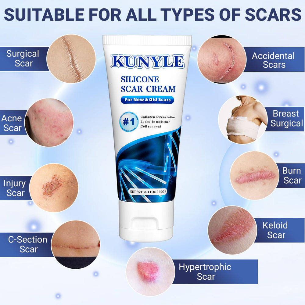 Kunyle Scar Cream applied to scar area showing smoothing progress
