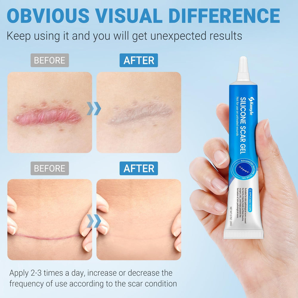 Kunyle silicone scar gel texture close up quick absorbing consistency