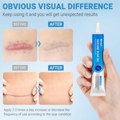 Kunyle silicone scar gel texture close up quick absorbing consistency