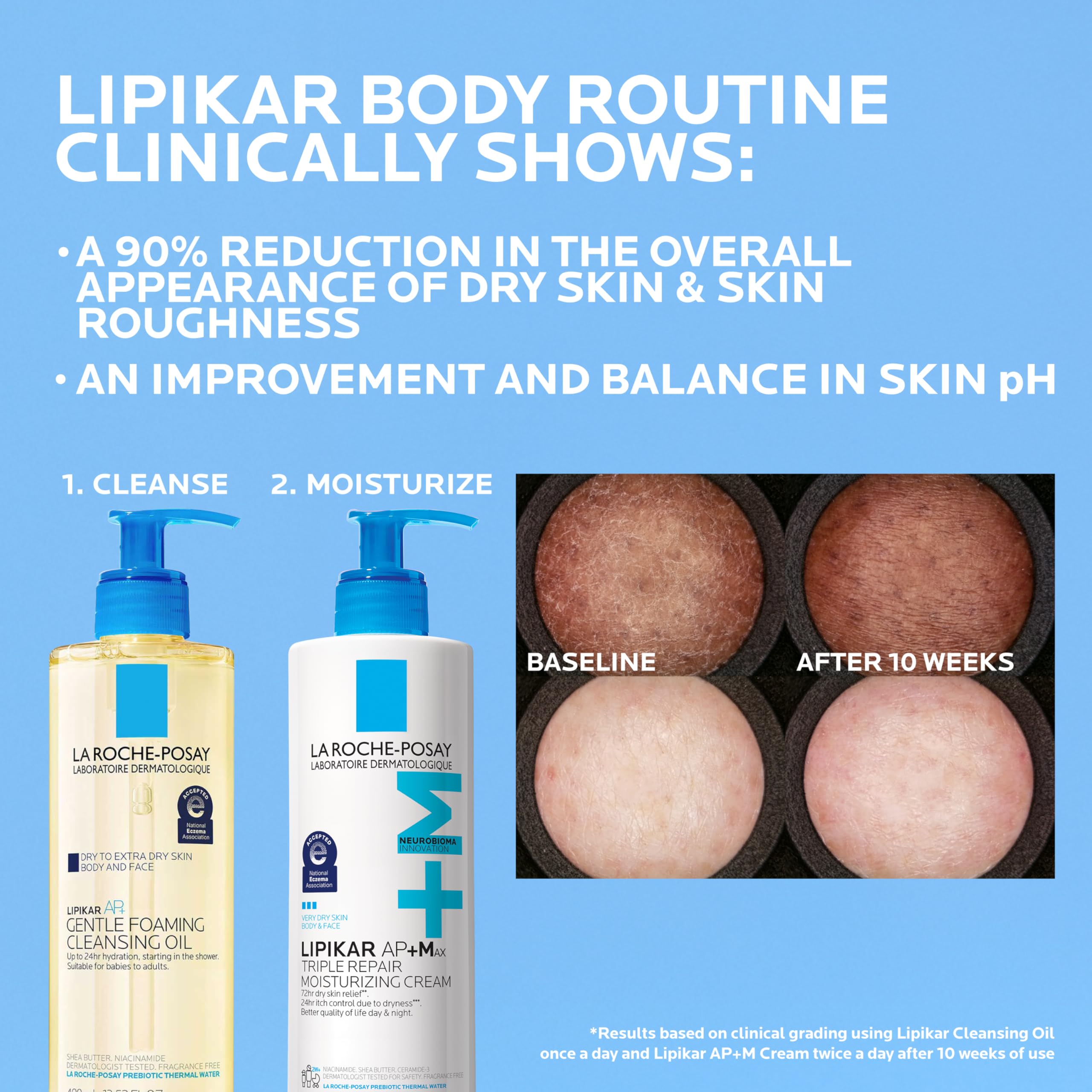 La Roche-Posay Lipikar AP+MAX before-and-after skin showing improved smoothness