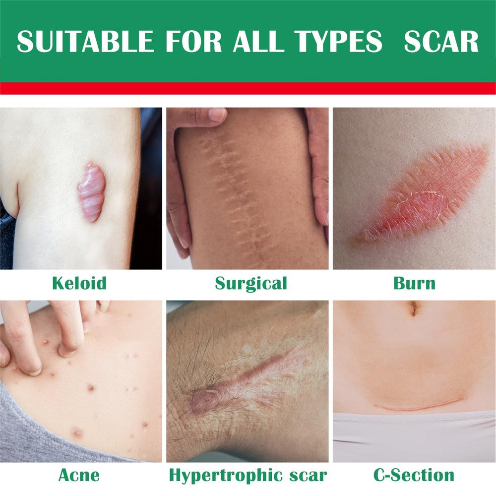 Ladygo silicone scar gel packaging highlights compact, travel-friendly design.