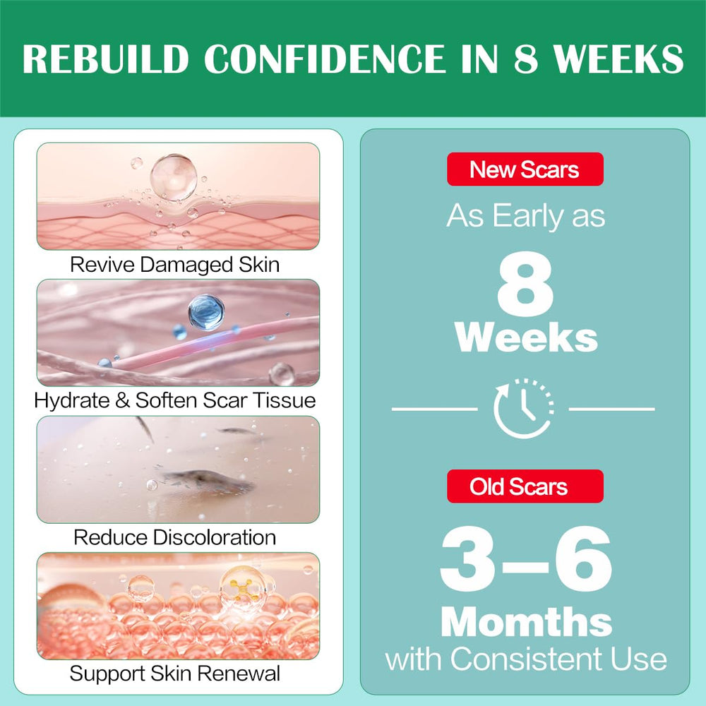 Ladygo Advance Silicone Scar Gel close-up reveals Vitamin E and allantoin nourishing skin.