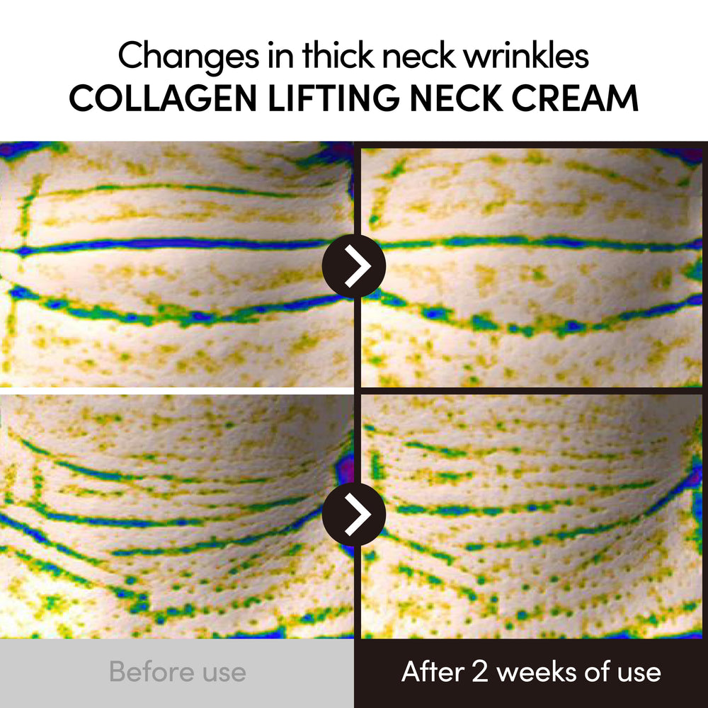 LAGOM Collagen Lifting Neck Cream side-view highlights jawline contouring potential.