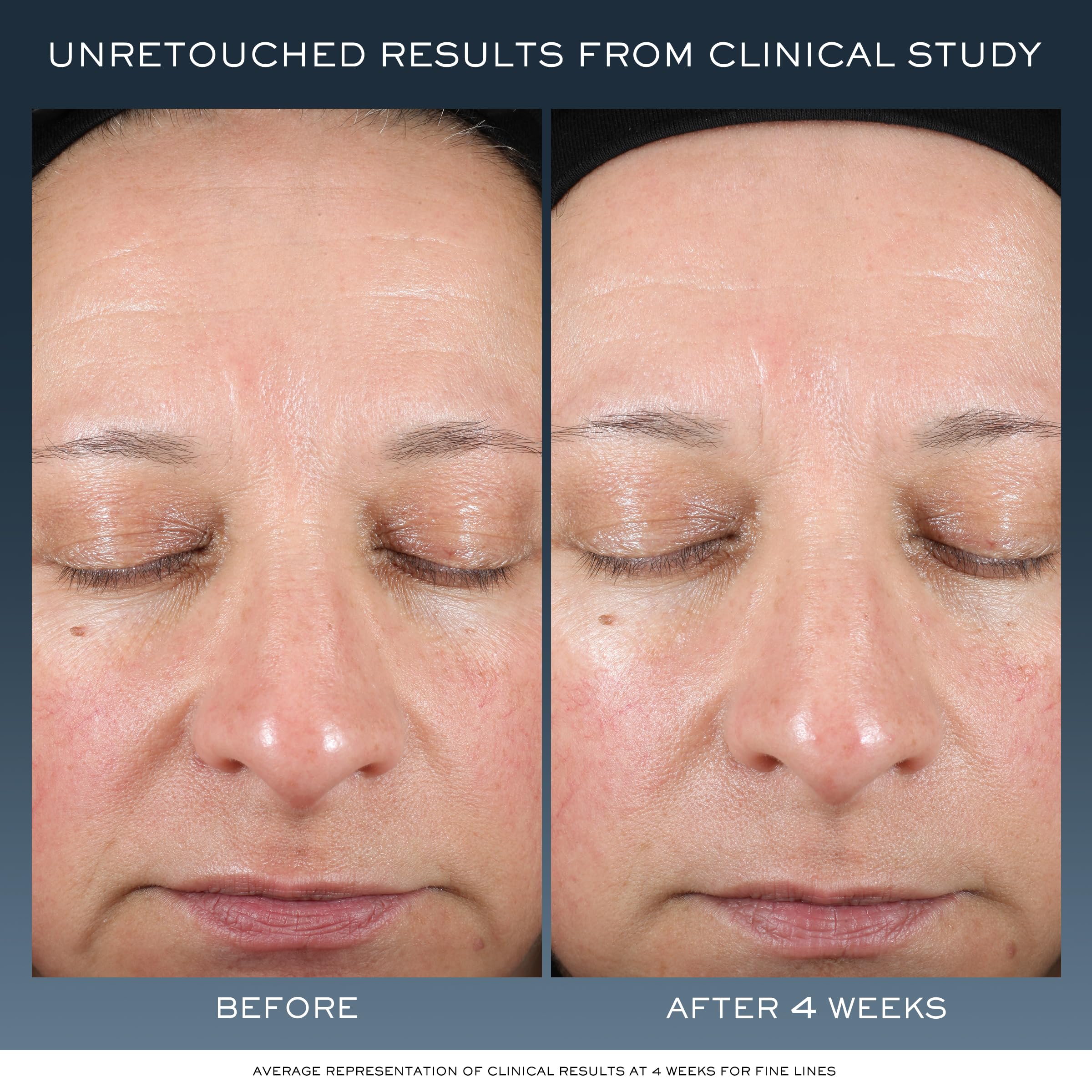 Lancôme Advanced Génifique Night Cream texture-melt demonstrates quick absorption and non-greasy finish.