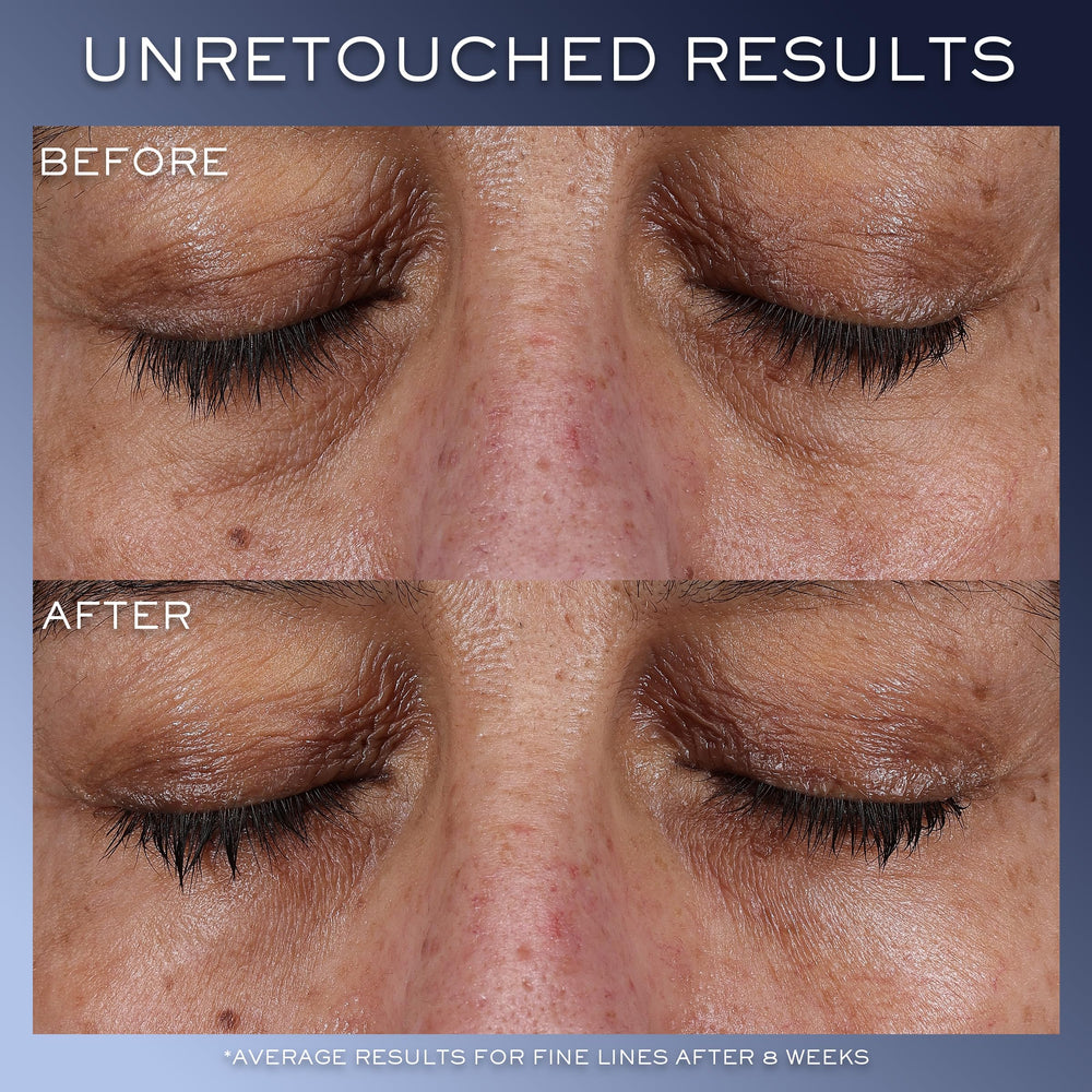 Lancôme Génifique Eye Cream application on skin for bright, even tone.