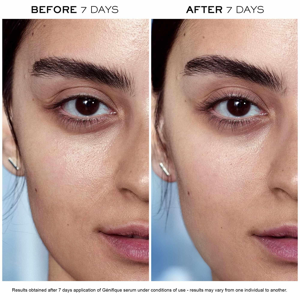 Lancôme Génifique hyaluronic-acid-moisture-boost highlights long-lasting skin hydration support