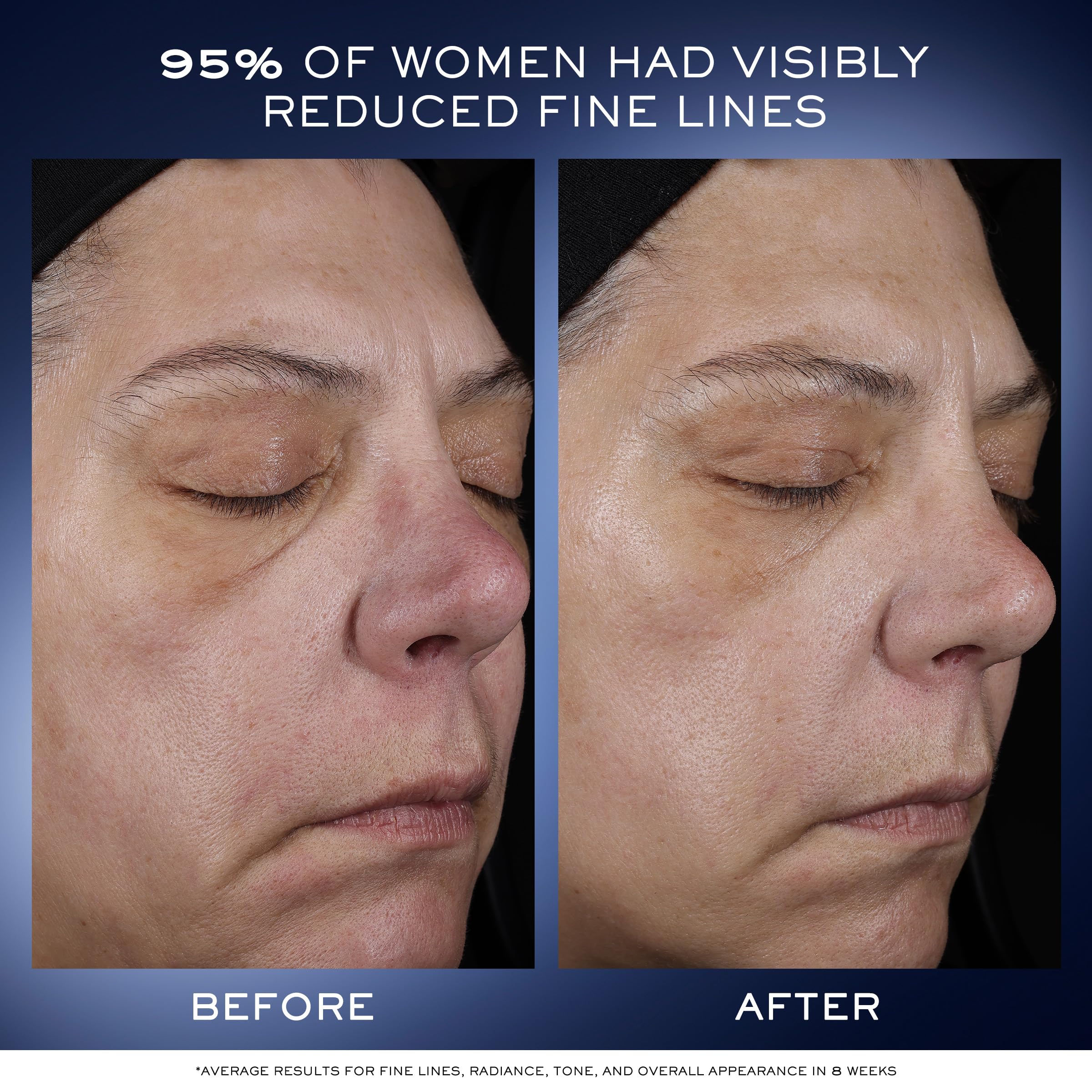 Lancôme Génifique Ultimate Dual Recovery Serum pump demonstrates easy, controlled application.