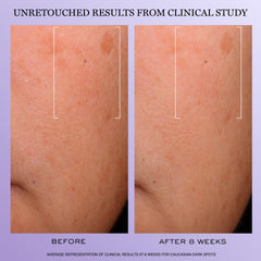 Lancorne Rennergie H.C.F. close-up shows smooth texture and fast absorption