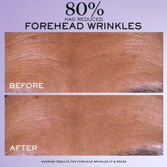 Lancôme Rénergie C.R.x retinol ingredient panel indicating visible aging improvement