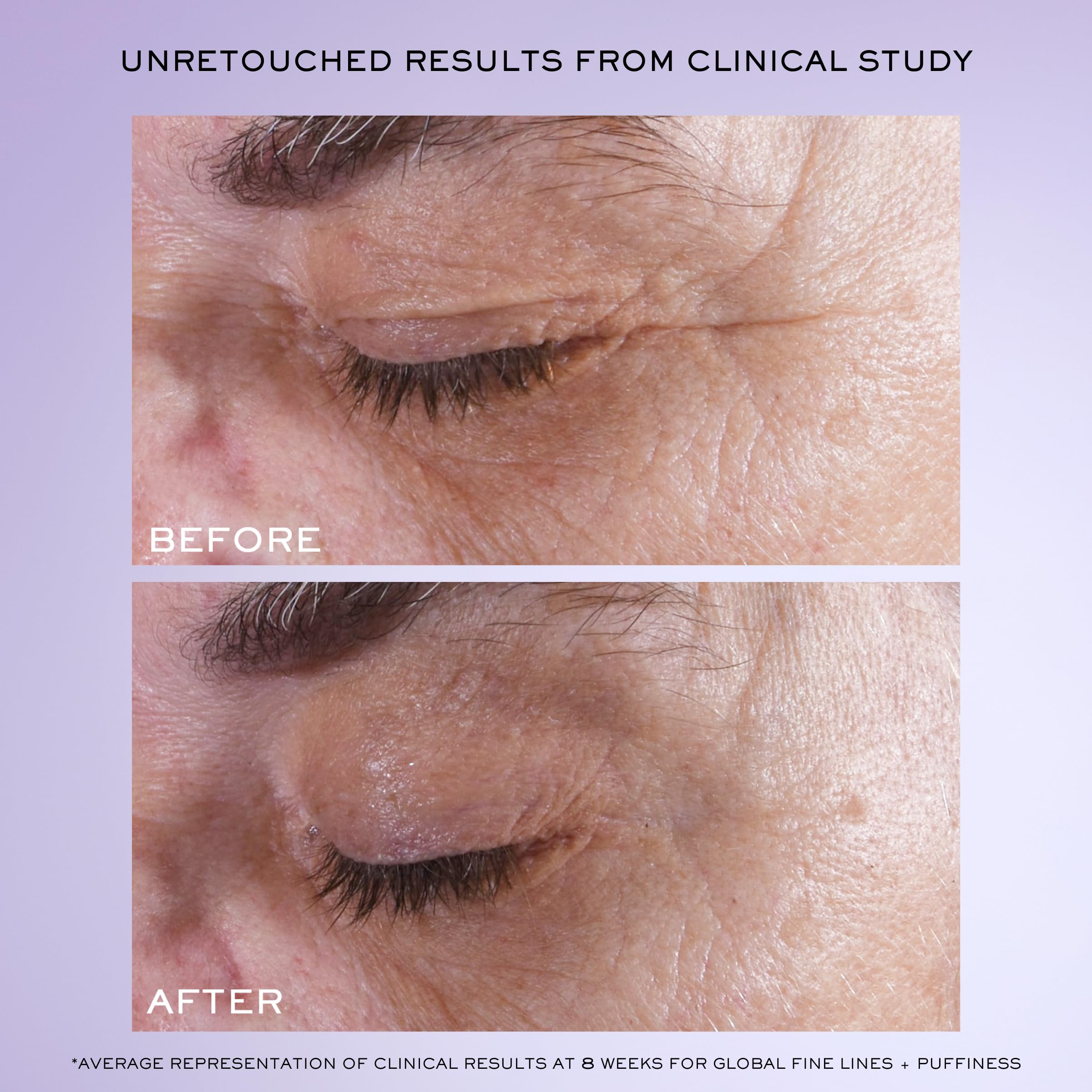 Lancôme Rénergie H.C.F. Triple Serum Eye application on under-eye highlighting fast-absorbing formula.