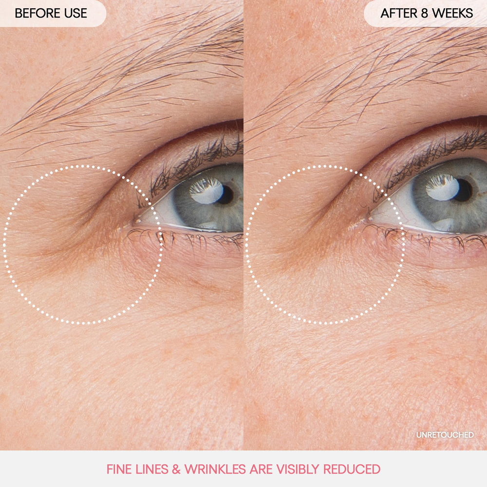 LANEIGE applying eye sleeping mask under-eye to reduce puffiness