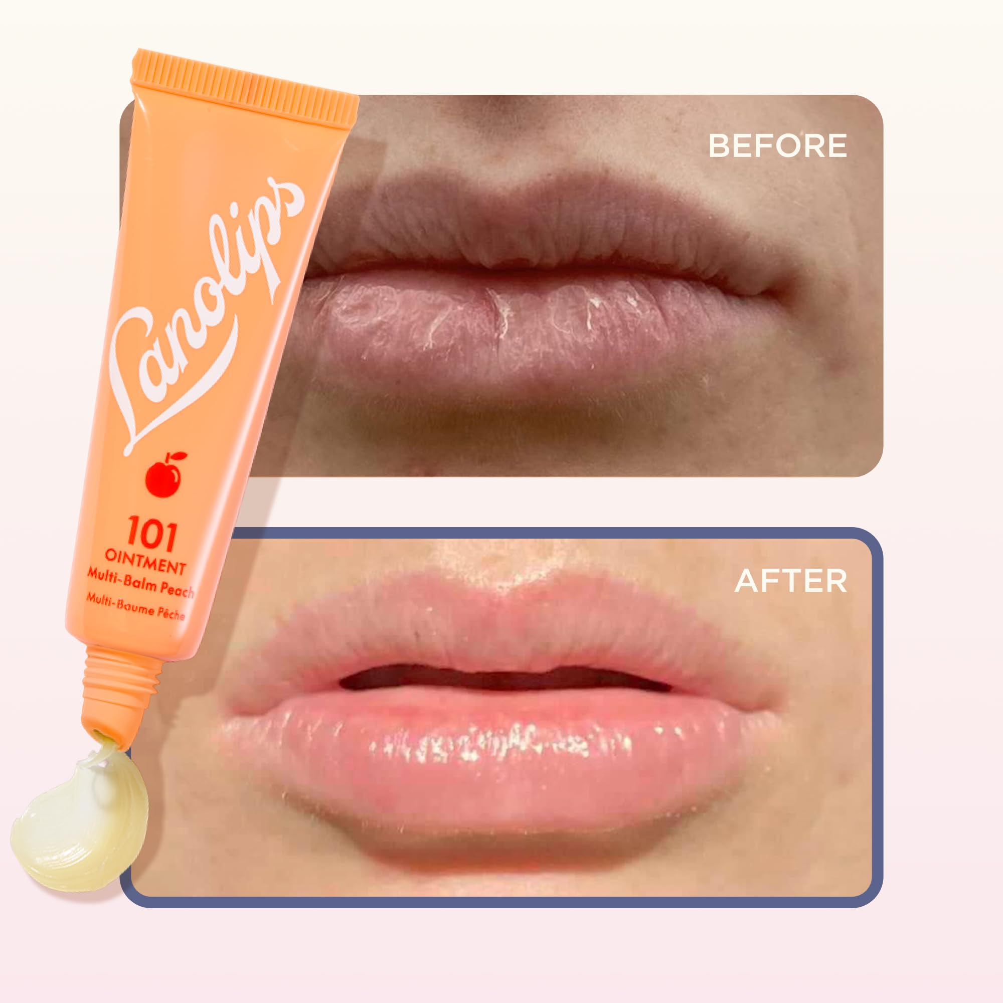 Lanolips 101 Ointment cruelty-free formula in use.