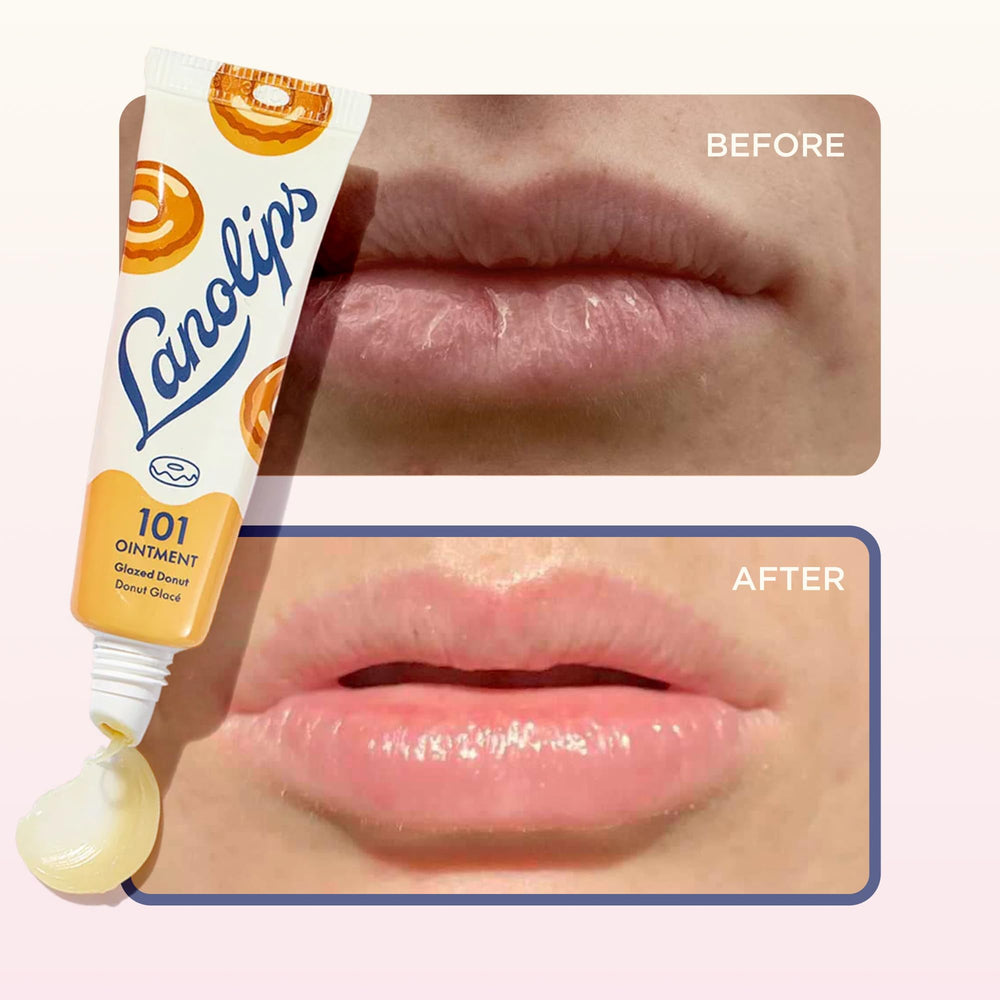 Lanolips 101 Ointment used on cuticles for gentle moisture.