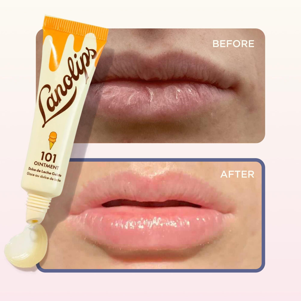Lanolips 101 Ointment cuticles use demonstrates multipurpose hydration around nails.