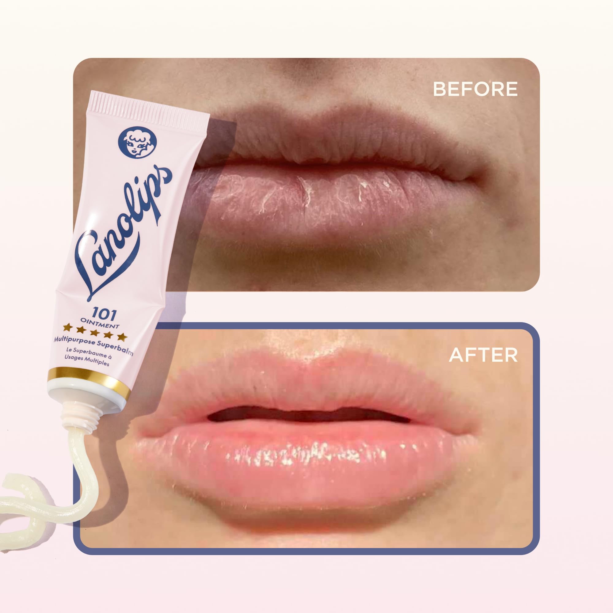 Lanolips 101 Ointment on cuticles demonstrating protective moisture and softness.
