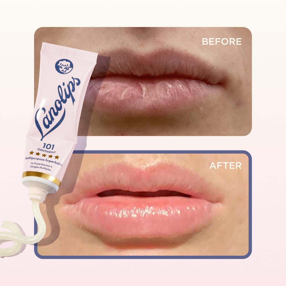Lanolips 101 Ointment on cuticles demonstrating protective moisture and softness.