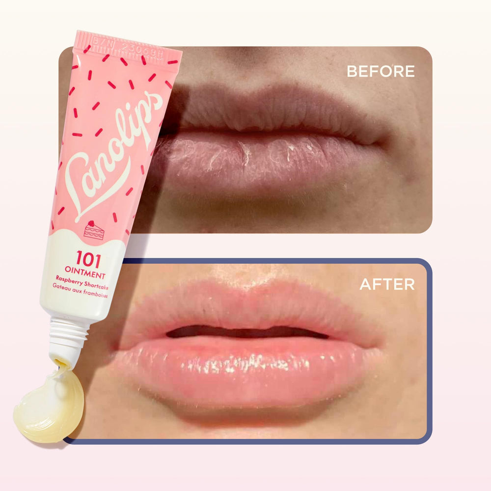 Pure Aussie lanolin content supports deep moisturization in Lanolips 101 Ointment.