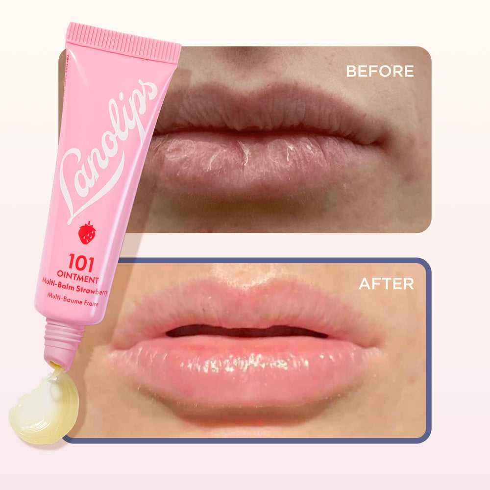 Lanolips 101 Pomada envase de 15 ml, fácil de llevar.