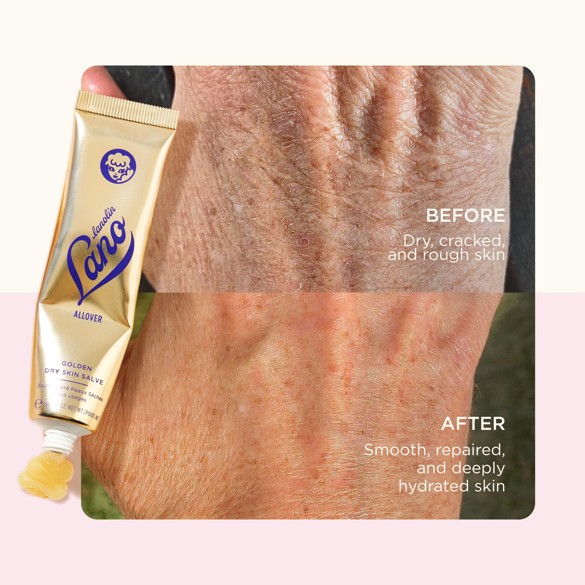 Lanolips Golden Dry Skin Salve on hands for cracked skin relief