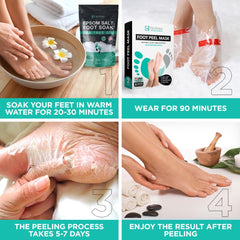 Lavinso Foot Peel Mask showing calluses softening on heel.