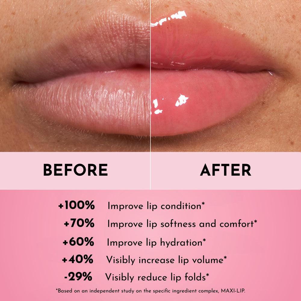 Lawless MAXI-LIP and Hyaluronic Acid close-up shows the active complex for smoothing.