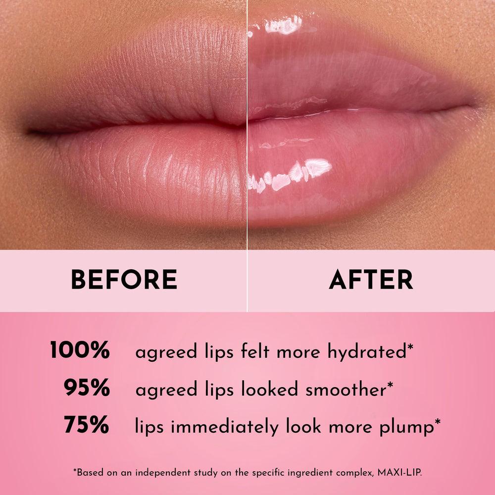 Lawless Forget the Filler packaging shot emphasizing cruelty-free vegan lip gloss.