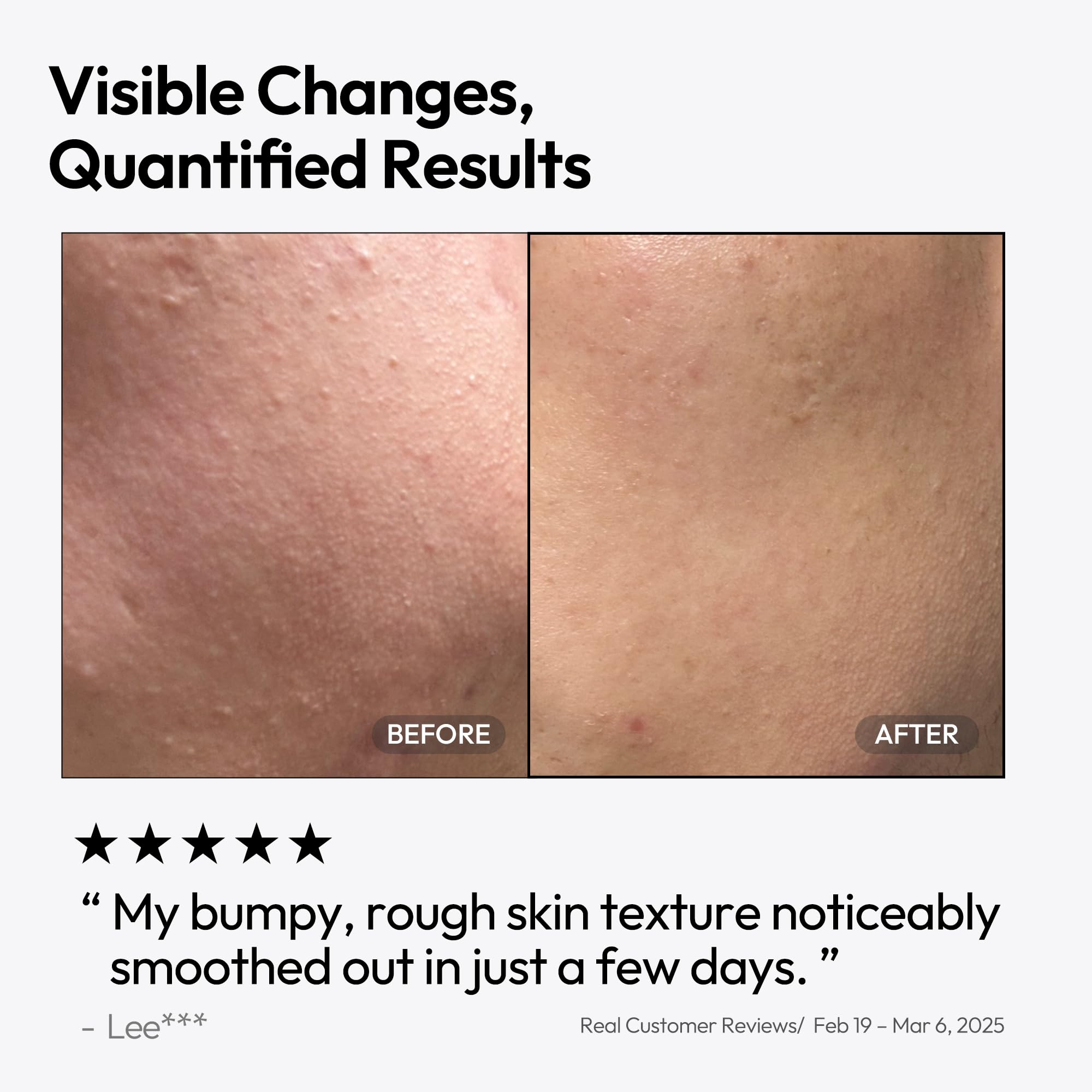 LayerLAB application routine image suggesting easy nightly layering with moisturizer