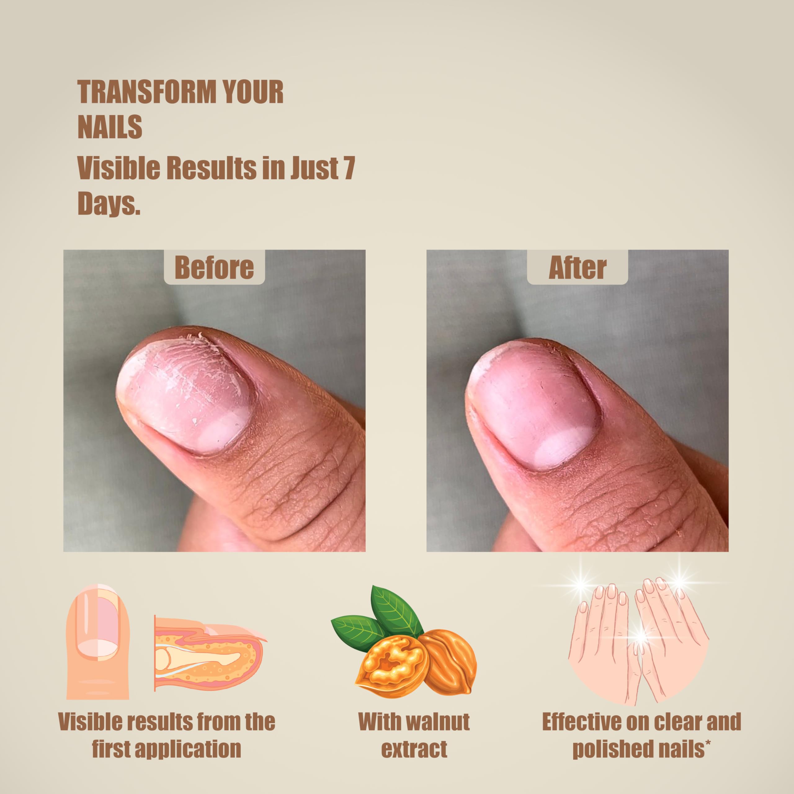 Lazonail hydrating formula nourishes cuticles for smoother nail edges