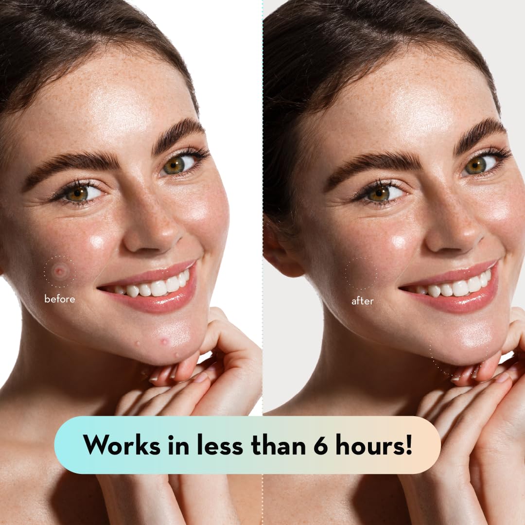 LE GUSHE tea tree oil patch with drop visuals for refreshing ritual
