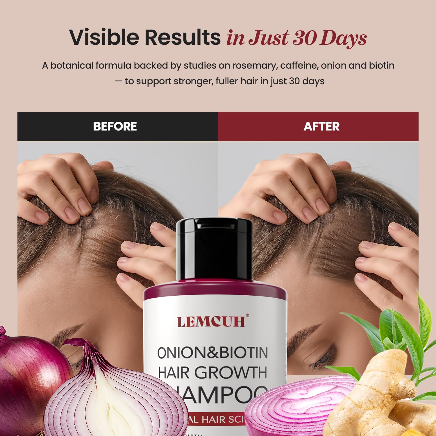 Lemcuh scalp care image highlights dandruff relief and soothing tea tree oil