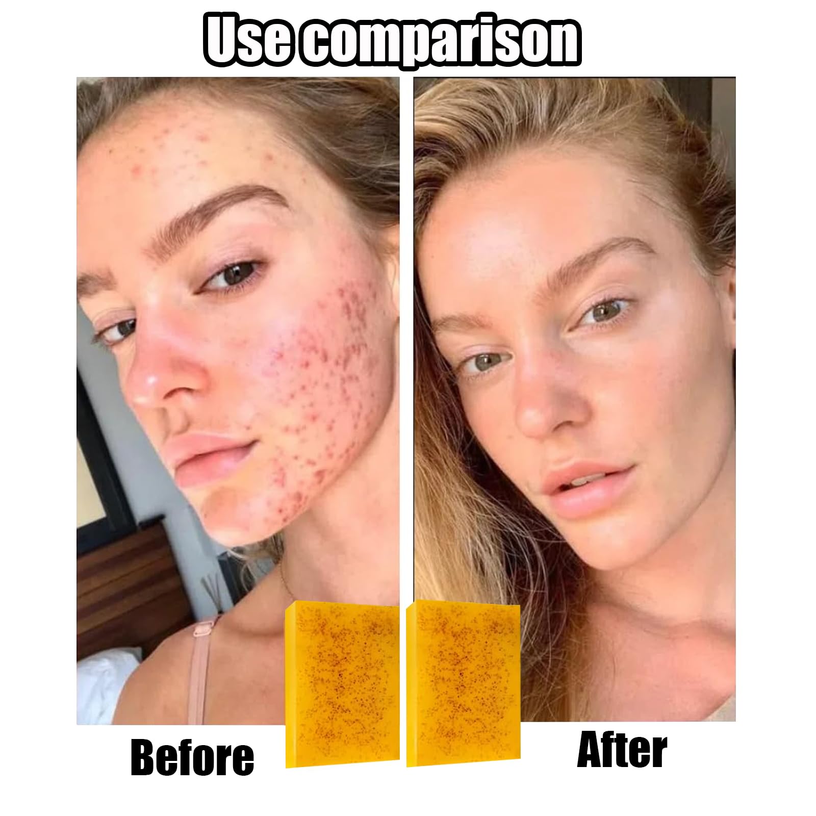 Lemon Turmeric Kojic Soap applied on skin for gentle massaging routine.