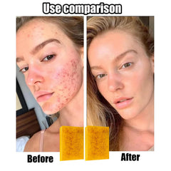 Lemon Turmeric Kojic Soap applied on skin for gentle massaging routine.