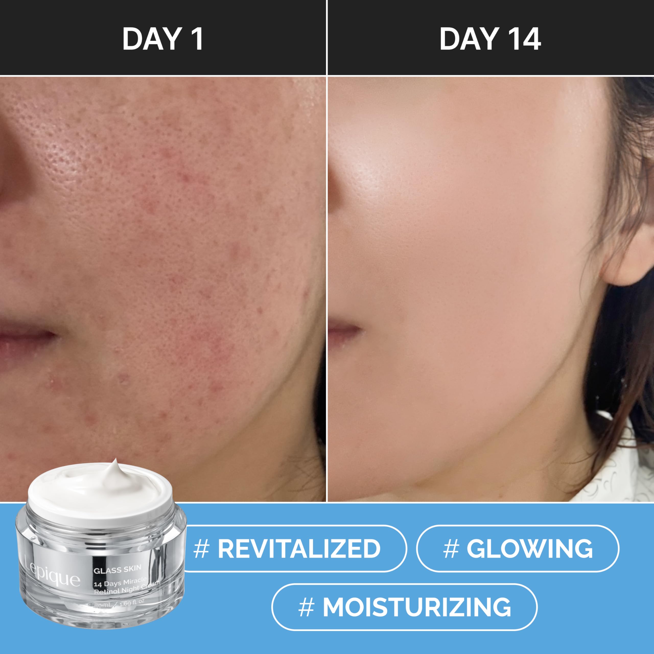 Lepique neck firming demonstration on application along jawline