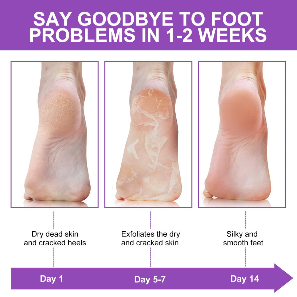 Liefiet Foot Peeling Mask 5Pack lavender scent enhances spa like care