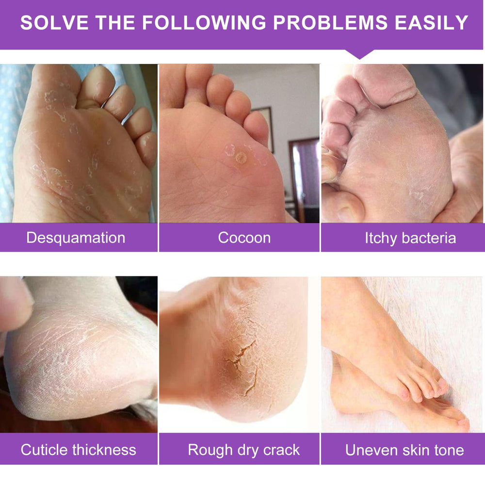 Liefiet Foot Peeling Mask 5Pack wearable socks demonstrate at home foot care