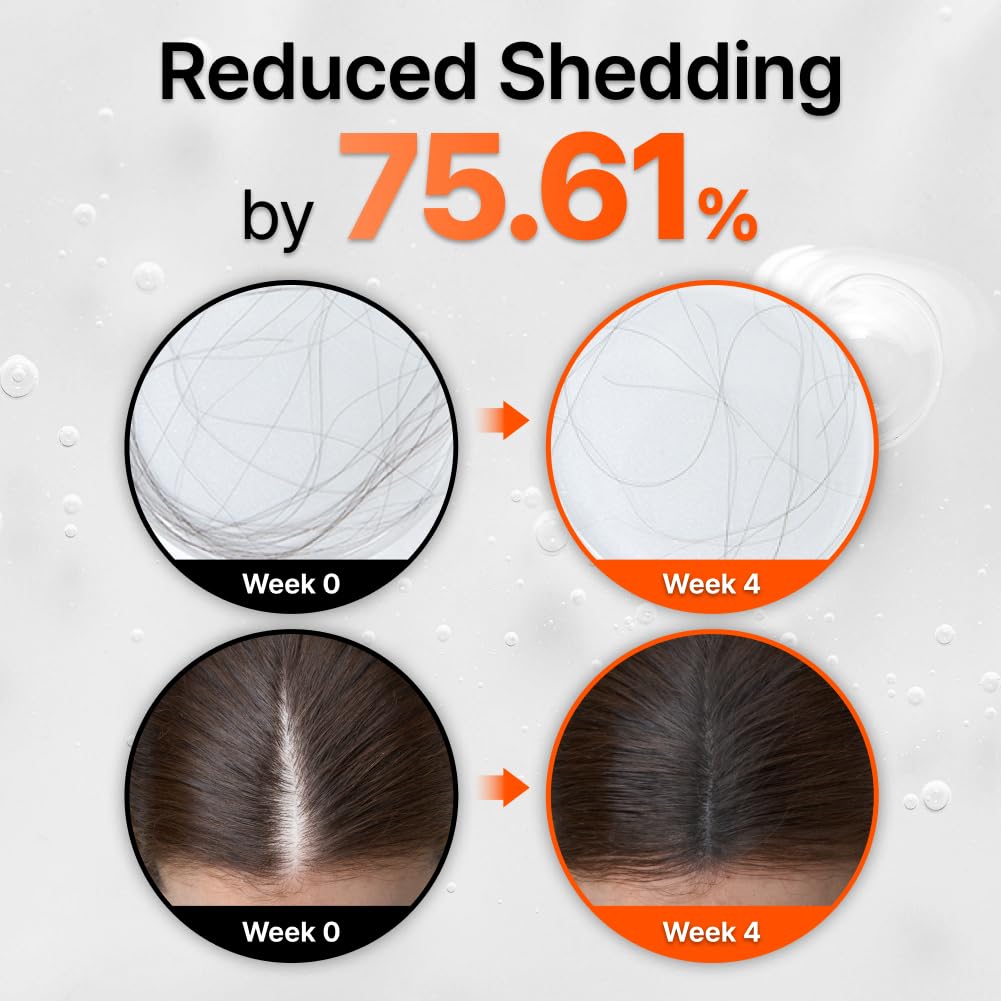 LilyEve GROWTURN exosome ingredients highlight soothing scalp care