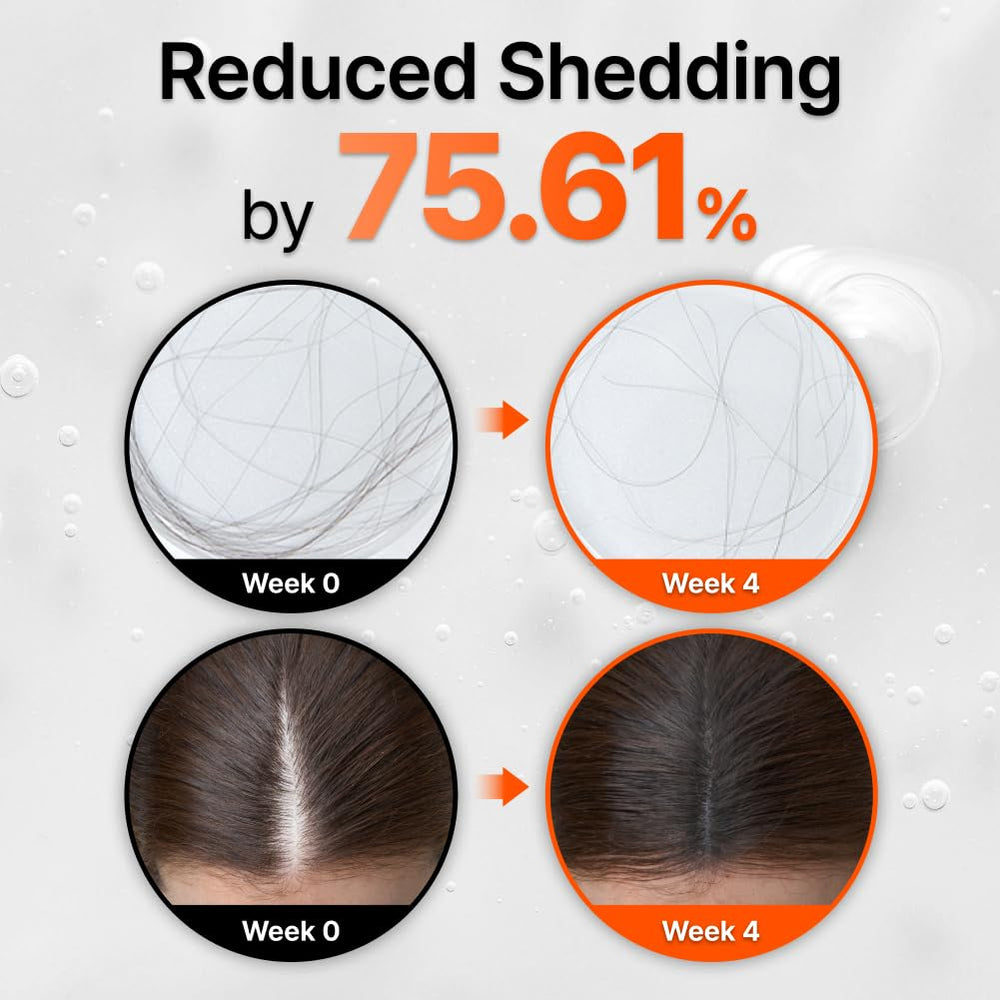 LilyEve GROWTURN exosome ingredients highlight soothing scalp care