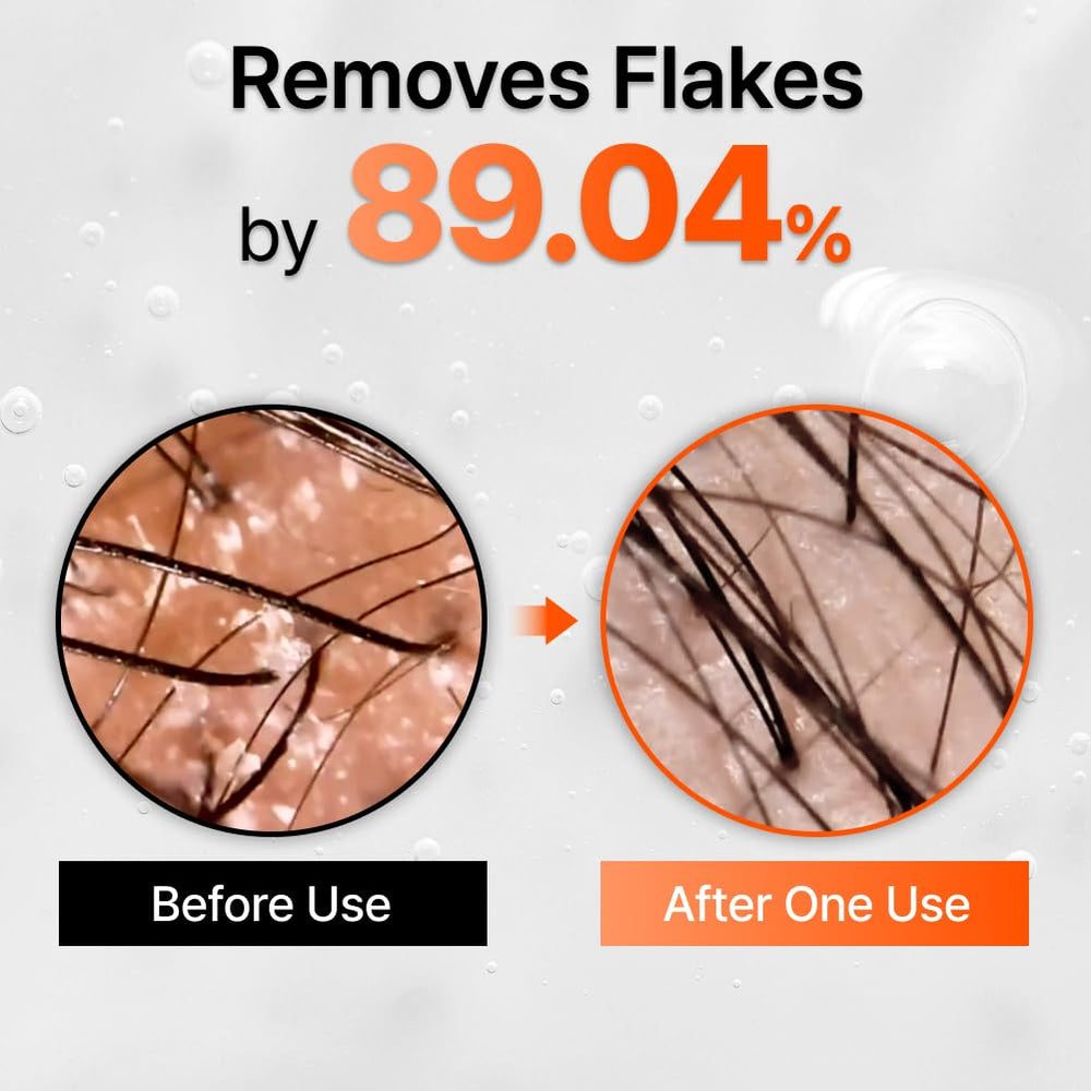 LilyEve GROWTURN hair thickness visualization suggests fuller-looking strands