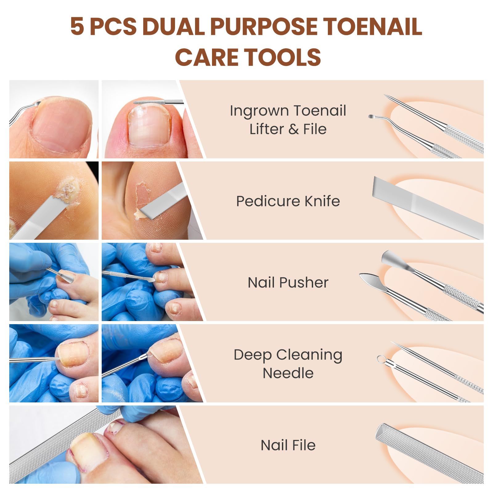LIONVISON ingrown-correction tools enable gentle at-home guidance.