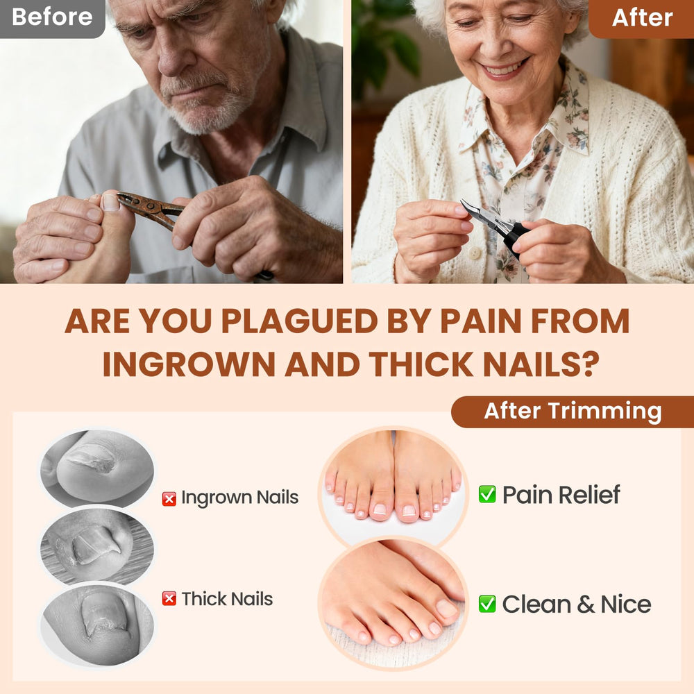 LIONVISON non-slip ergonomic handles aid comfortable use for arthritic hands.